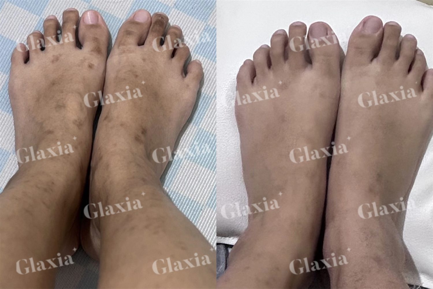 Glaxia before and after — customer result 5